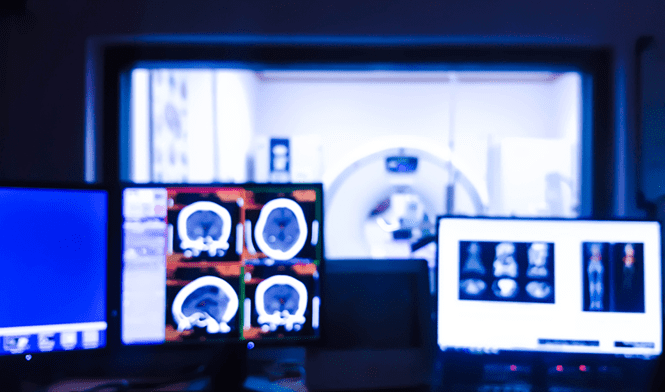 Optimize Your Radiology Practice Revenue with RCM Matter